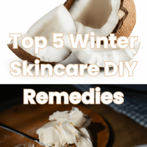 Top 5 Winter Skincare DIY Remedies for Dry, Flaky Skin