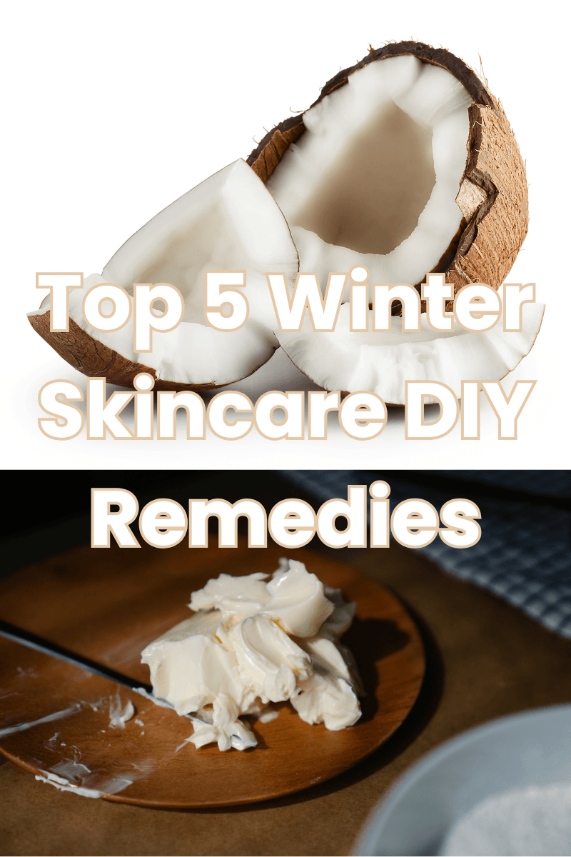 You are currently viewing Top 5 Winter Skincare DIY Remedies for Dry, Flaky Skin