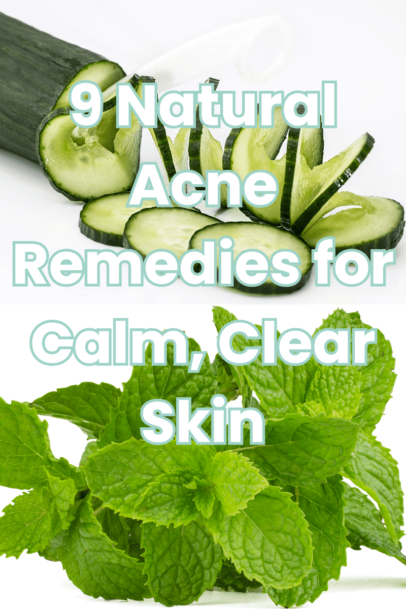 You are currently viewing 9 DIY Remedies for Acne-Prone Skin Using Kitchen Ingredients