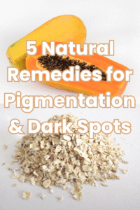 Read more about the article Top 5 Natural Treatment for Pigmentation Remedies You Can Try at Home