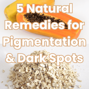Top 5 Natural Treatment for Pigmentation Remedies You Can Try at Home
