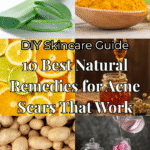 10 Best Natural Remedies for Acne Scars That Actually Work Wonders