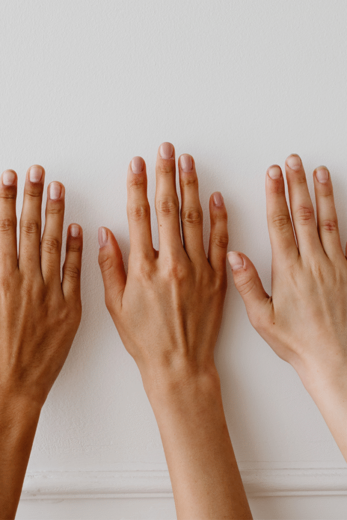 Types of sensitive skin explained in 10 Sensitive Skin Care Tips